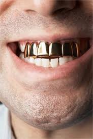 Uses Of Gold In Dentist